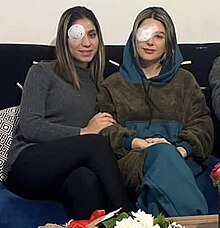 From left to right, Kosar Eftekhari sitting alongside Elaheh Tavakolian, both with white eye patches over their right eye.