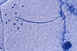 Dernière étape du cycle court de H. parasitica : apparition d'un conidiophore (structure arbusculaire bleue portant les conidiospores.