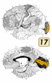 Calcarine sulcus highlighted in Brodmann Area 17, lateral and medial views.