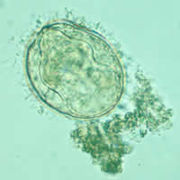 A Schistosoma mekongi egg.