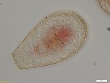 Planocarina marginata, a hyalospheniid amoeba