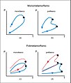 Possibili percorsi P-T-t nel caso di monometamorfismo (a e b) e polimetamorfismo (c e d). Ciascuna linea rappresenta un evento metamorfico. (a). Percorso P-T-t monofase in senso orario; (b). Percorso polifase in senso antiorario; (c). Due eventi monofasici; (d). Due eventi polifasici. Gli asterischi indicano i picchi termici con sviluppo di nuove paragenesi. Da Smulikowsky et al., 2003.