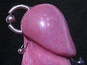 Male: Rings on penis