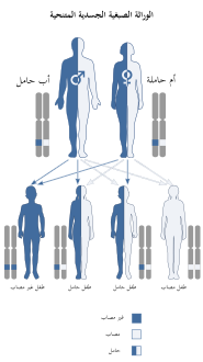 هذه الحالة تُتوارث بطريقة "صبغية جسدية متنحية" (بالإنجليزية: autosomal recessive)‏.