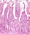 Normal small intestine