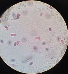 Description de l'image Chromatium Okenii al microscopio.jpg.