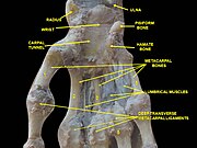 Bilek eklemi. Deep dissection.Anterior, palmar, view.(Önden)