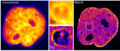 fBALM Super-resolution single molecule localisation microscopy using DNA structure fluctuation assisted binding activated localisation microscopy