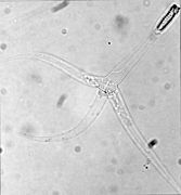 Myxobolus cerebralis (Myxozoa)