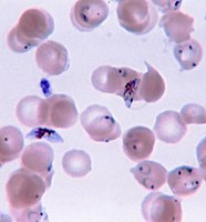Plasmodium falciparum (Apicomplexa) in blood