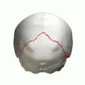 Parietal bones (above) and occipital bone (below).