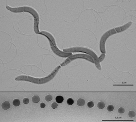 Acetobacter aceti