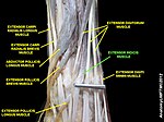 Extensor indicis muscle