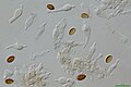 Psilocybe subaeruginosa cheilocystidia 600x