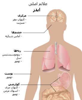 تصویر نیم تنه انسان که در آن شایع‌ترین علائم ایدز مشخص شده‌است