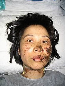 The disfigured face of Gao Rongrong