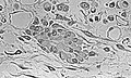 Osteoprogenitor cells