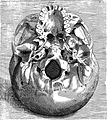 Illustration of human skull by Coiter