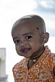 Image 10A Hindu girl after her Karnavedha rite of passage (ear piercing) (from Samskara (rite of passage))