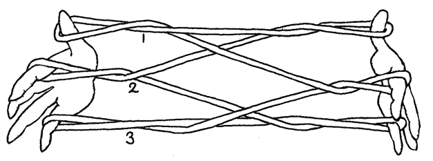 Archivo:String figure.tiff