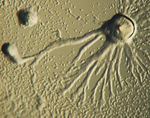 Dictyostelium discoideum