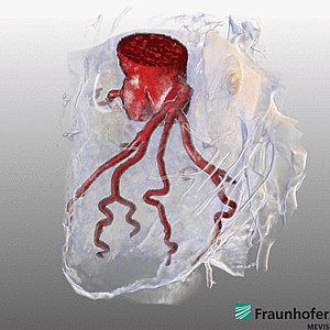 Heart rendered in MeVisLab