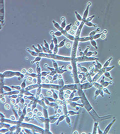 Description de l'image Trichoderma_harzianum.jpg.