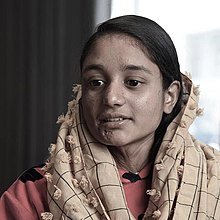 Portrait en couleur d'une jeune femme d'origine asiatique ayant des cicatrices au niveau du menton.