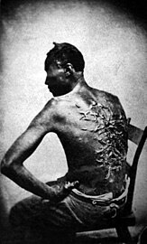 Famous photo of a slave with scars from many whippings; Louisiana, 1863