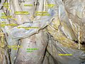 Ascending aorta