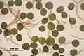Conocephalum salebrosum, spores and elaters