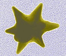 TEM image of a star-shaped nanoparticle prepared by NIST