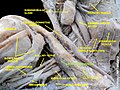 Subclavius muscle- right view