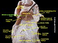 Median glossoepiglottic fold