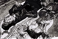 Vítimas civis azeris do Massacre de Khojaly.