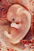 A 9-week human embryo