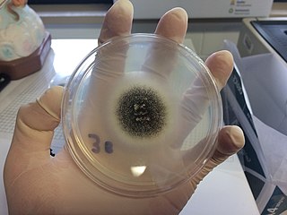 Aspergillus niger growing on potato dextrose agar