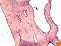 Bone by decalcification (40x): Volkmann's canal Haversian canal Blood vessel