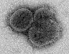 Electron micrograph of Bourbon virus
