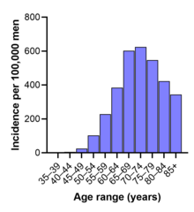 Graph showing that prostate cancer incidence is very low in men under 50, and peaks in men over 65.