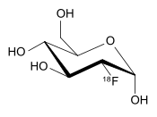 Image illustrative de l’article Fluorodésoxyglucose (18F)