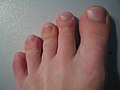 toe