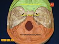 Posterior cranial fossa