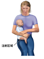 婴幼儿股外侧肌注射区域