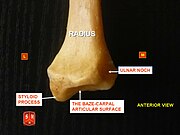 Radius, styloid process - anterior view