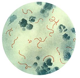 Streptococcus pyogenes при 900-м увеличении.