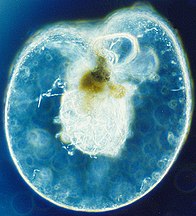 Noctiluca scintillans, a bioluminescent dinoflagellate[215]