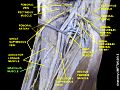 Gracilis muscle