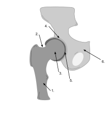 schéma d’une articulation de la hanche avec 6 flèches de repérage