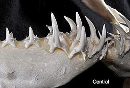 Central teeth